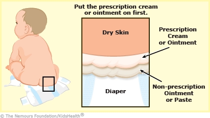 KidsHealth Image
